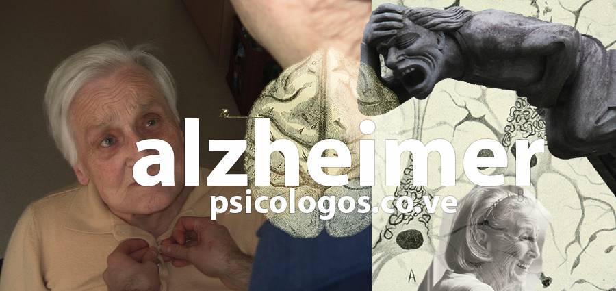 alzheimer y demencias